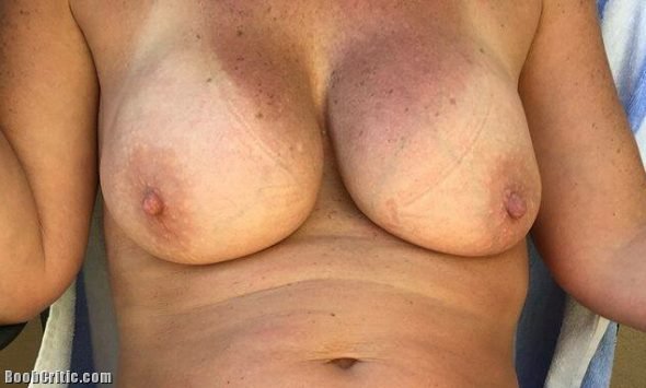 48 year old wife Liz’s boobs tanlines